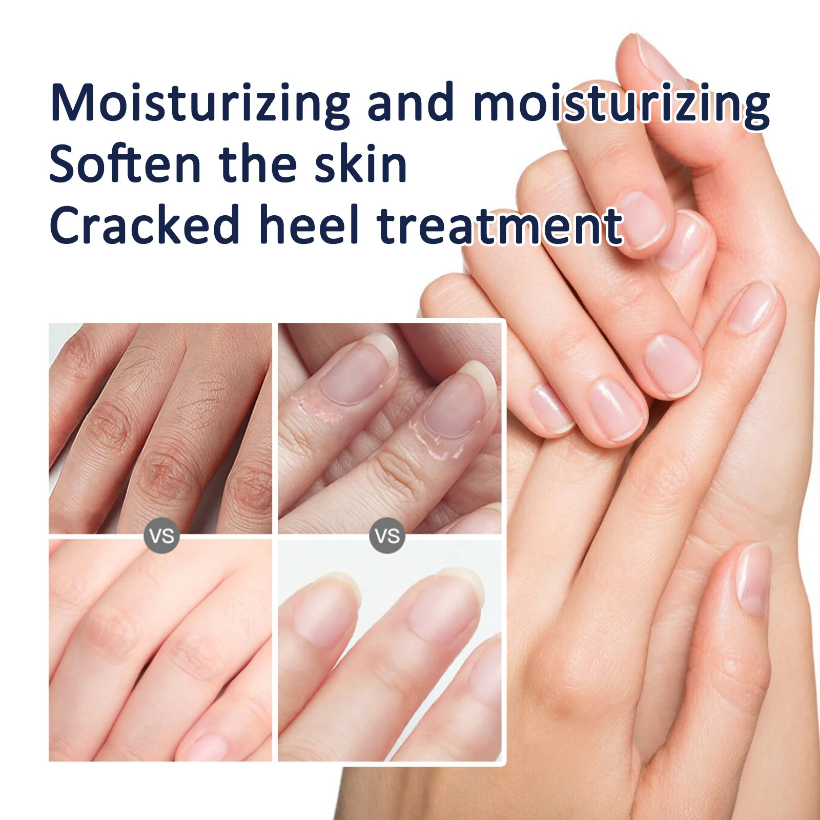 1Pc 40G Anti-Drogende Crack Voet Handcrème Hiel Gebarsten Reparatie Handvoeten Masker Hydraterende Whitening Dode Huid Verwijdering Huidverzorging