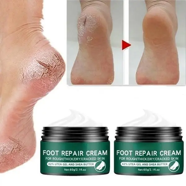 Newest Hand and Foot Skin Repairing Moisturizer Cream Anti-Chapping for Rough Dry and Cracked Chapped Feet Heel Repair Foot