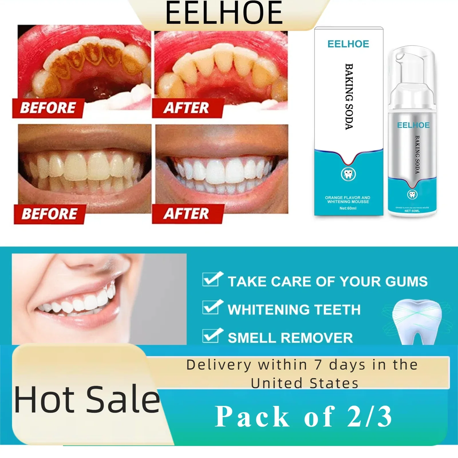 Mousse dentária tipo imprensa, 2 a 3 peças, remove manchas de tabaco, remove dentes amarelos, refresca a respiração e ilumina efetivamente a boca