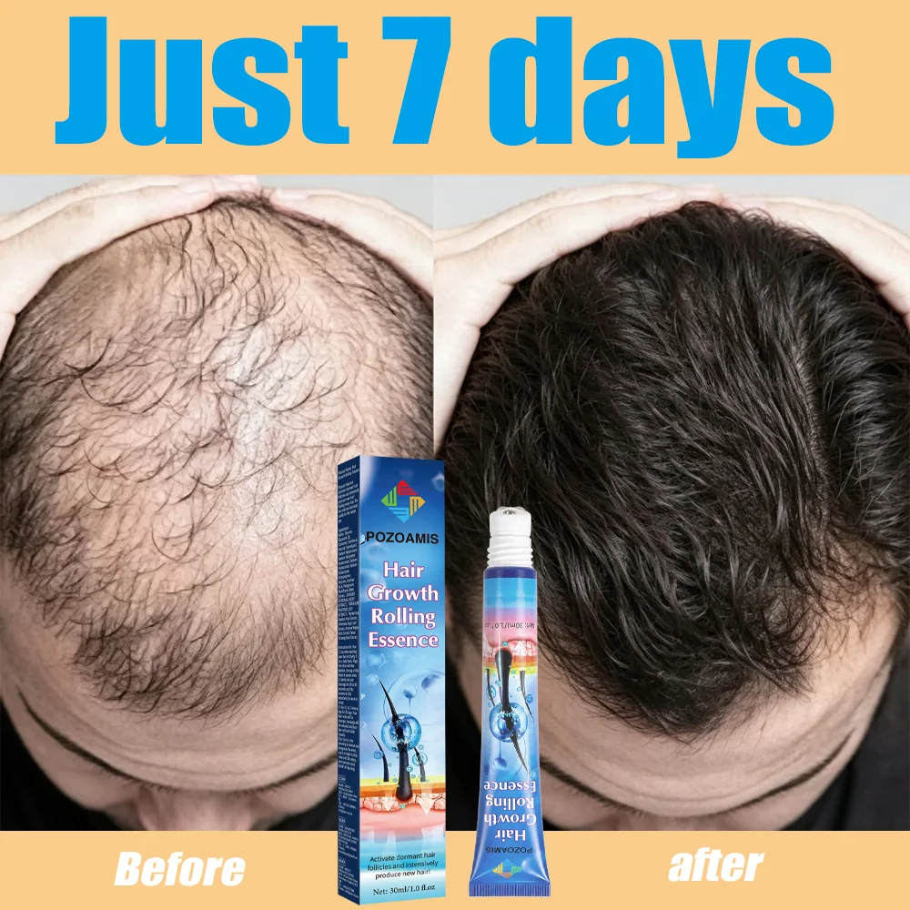 No Need To Apply With Your Hands! The Roll-on Design Makes Nourishing Hair Roots Super Convenient.