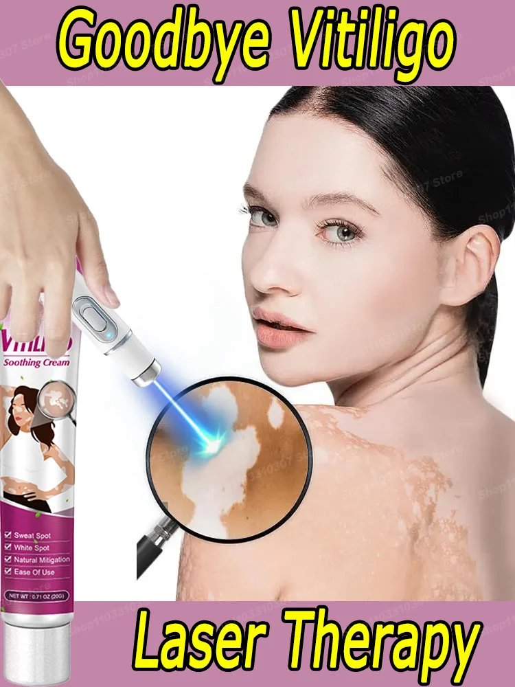 Vitiligo Pen Blue Light Laser