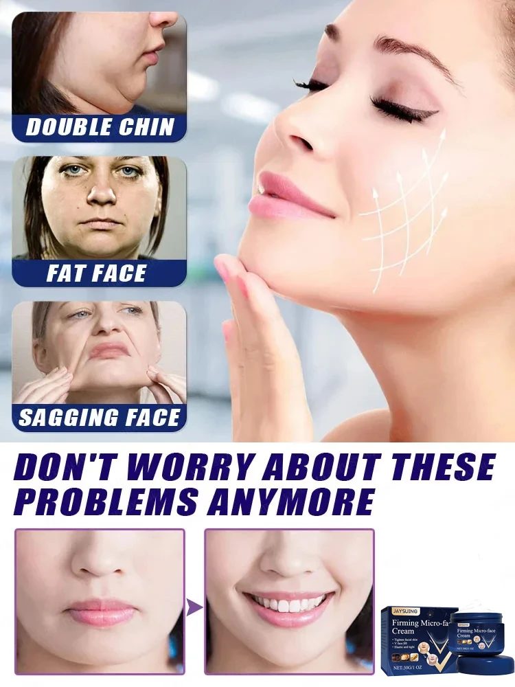 Remove Double Chin Cream