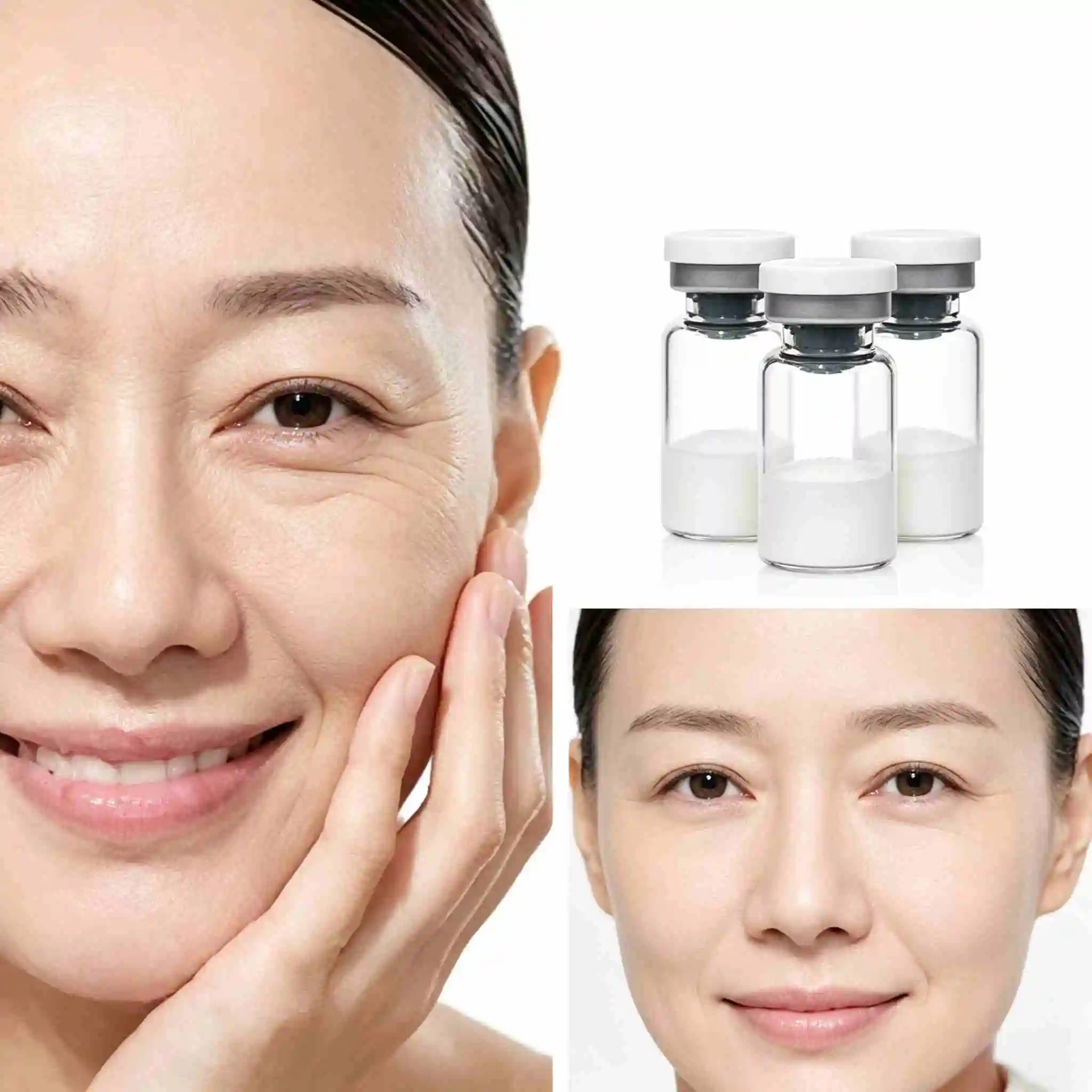 (Random Cap Colors, Production Date Subject to Actual Goods) High‑Quality CP10 Freeze‑Dried Powder, 10 Vials Per Box，anti acne