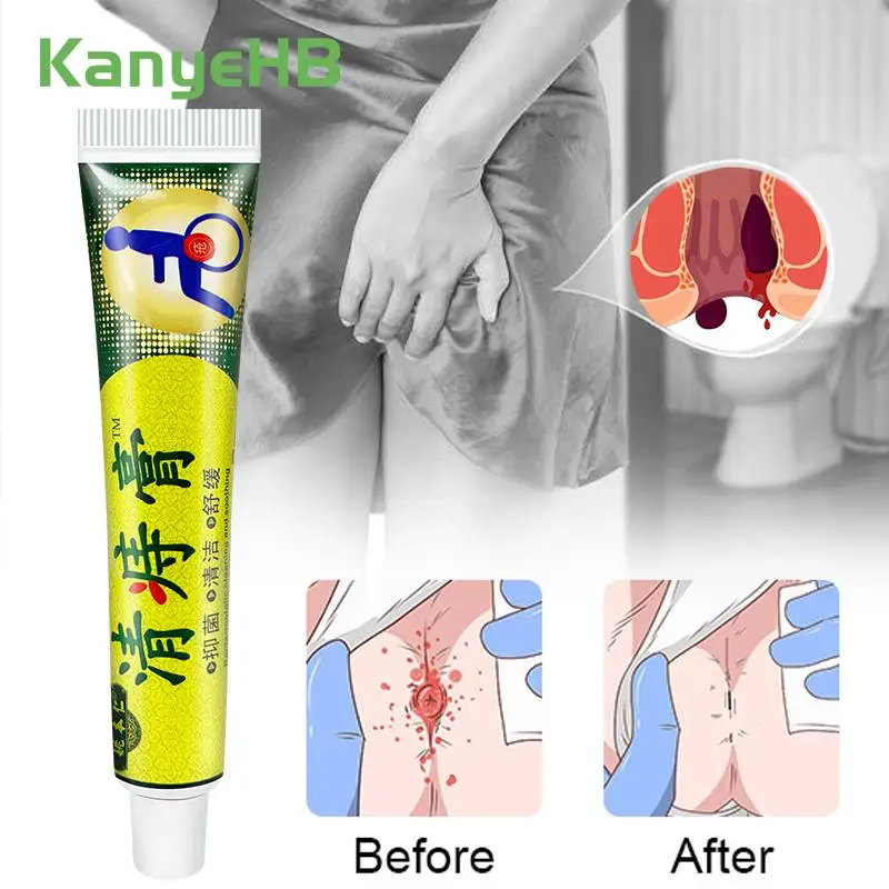 1Pcs Hemorrhoids Ointment Chinese Herb Medicine Health Care Mixed Hemorrhoids Cream Relieve Anal Pain Swelling Anal Fissure S051