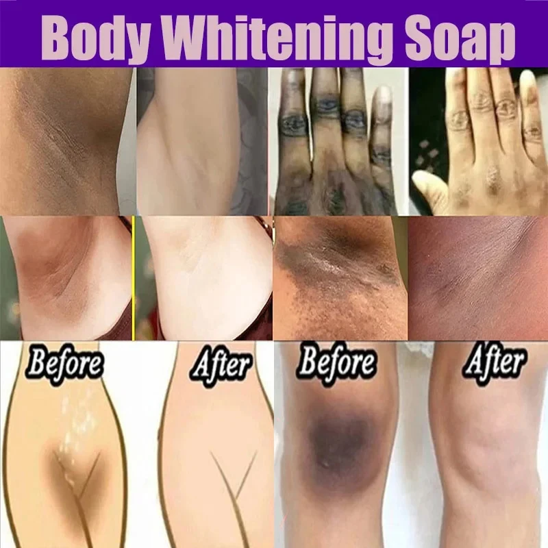 Body Whitening Soap Deep Clean Skin Reduces Dark Spots Armpit Underarm Knees Bleaching Body Brighten Skin Care Products New