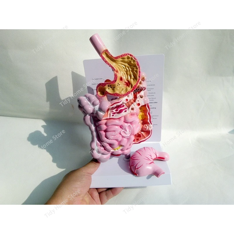 Adult Human Digestive System Large Intestine Model Duodenal Visceral Gastrointestinal Medical Anatomical Model