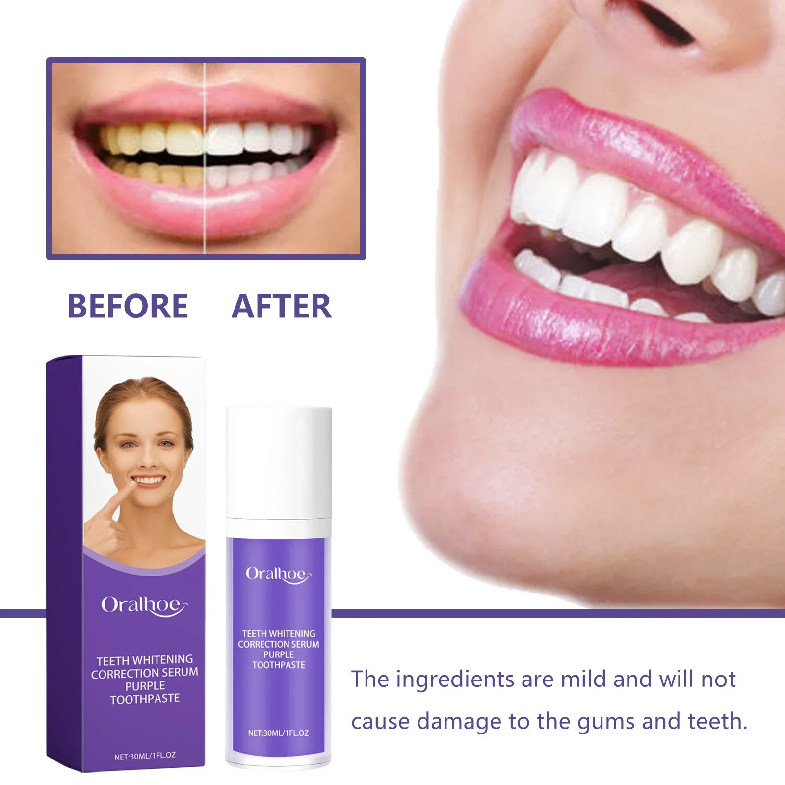 5pcs Purple Whitening Toothpaste Cleans Stains Freshens Breath Eliminates Odor Removes Tartar Protects Gums, Cares 30ml