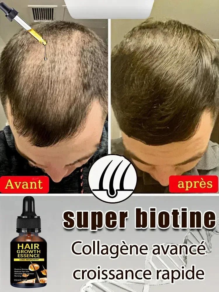 

02[Official authentic] 99% repurchase, more and more hair, say goodbye to baldness, hot selling product