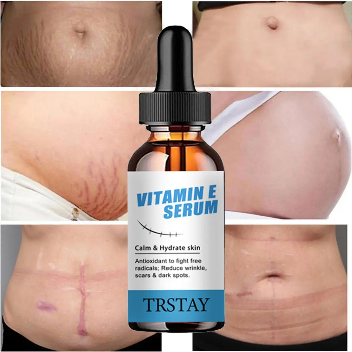 TRSTAY فيتامين E جوهر العناية بالبشرة مرطب التجاعيد الحد من الندبات والبقع يتلاشى للعناية بالحمل Striae Gravidarum #5