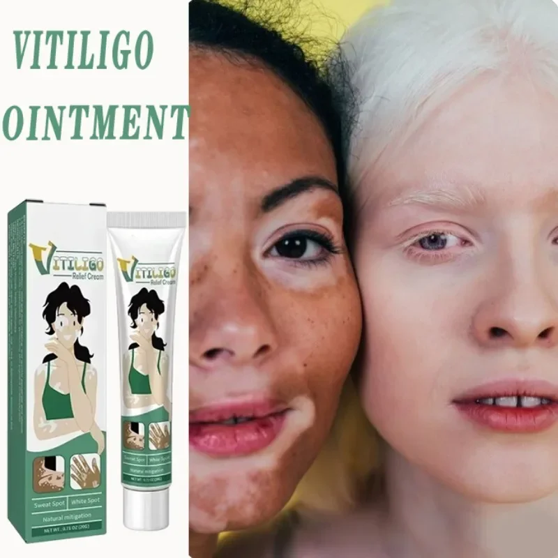 

Vitiligo Removal Cream Vitiligo Cleansing Facial Care Skin Care Skin care-cream Reduces White Spots on Skin even