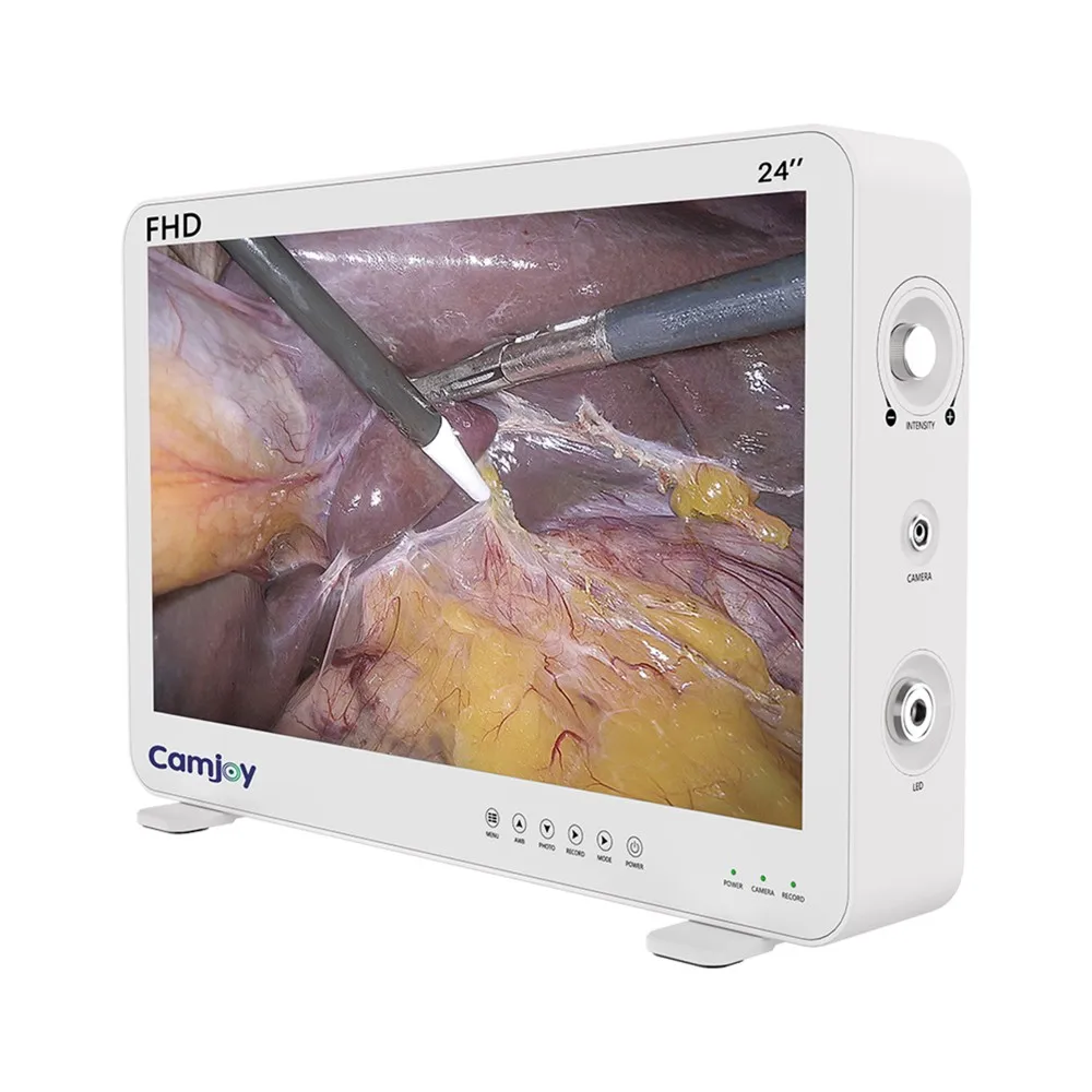 

CF924 Full HD 1080p Endoscopic Video Camera for Laparoscopy/Urology/Hysteroscopy/ENT