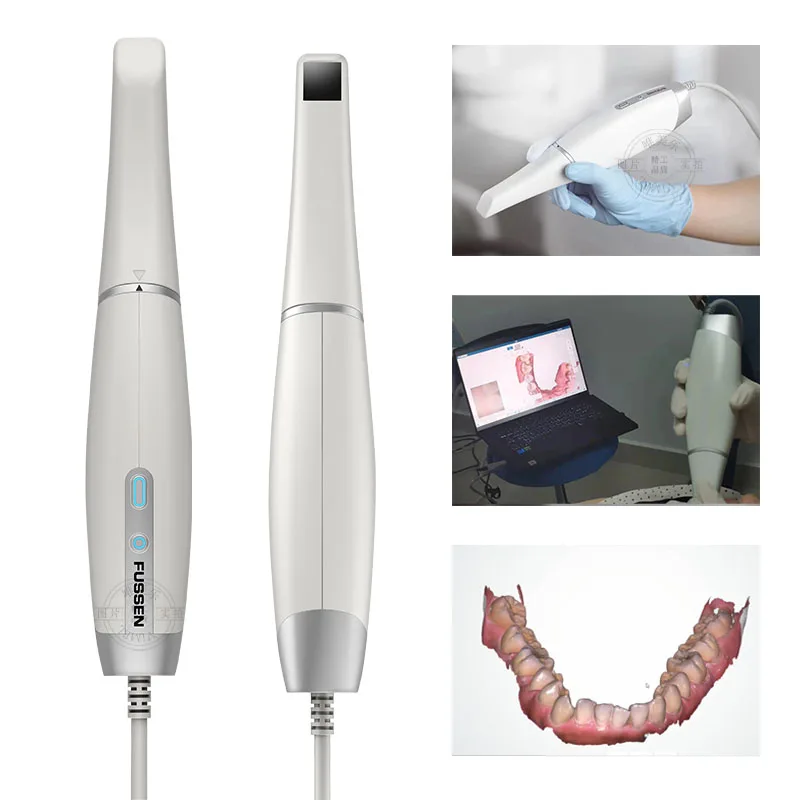 Fussen S6000 Dental 3D Digital Intraoral Scanner Color Scanning 3D High Resolution with High Precision Intraoral Camera