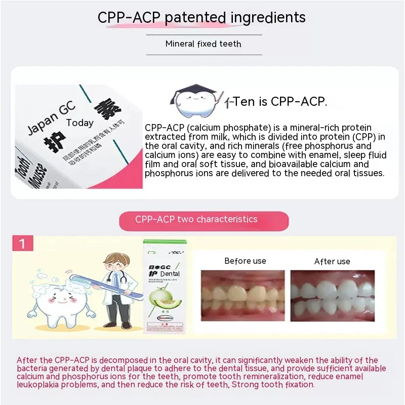 Kinderfluoridehoudende Tandcoating Met Aardbeiensmaak Om Tandbederf Te Voorkomen, Demineralisatie Van De Orthodontische Witte Vlek