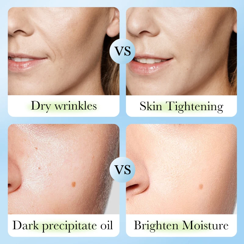 

120ml Bioaoua Deep Sea Moisturising Toner New Whitening And Brightening Care Products Essence Water For Women Studen Y7n8