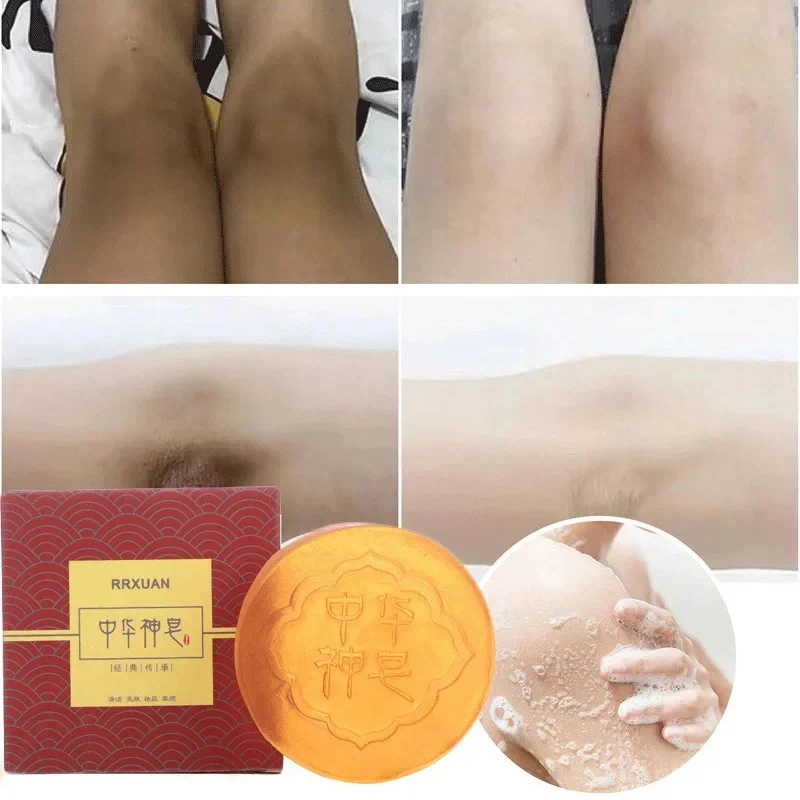 Deep Clean Skin Body Whitening Soap Chicken Skin Removal Soap Armpit Underarm Knees Bleaching Body Brighten White Care Products