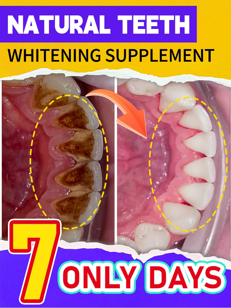 

Dental care, removal of stains, stones, fresh breath，Teeth Bleaching Breath Freshener Polish Yellow Stain Remover Brighten