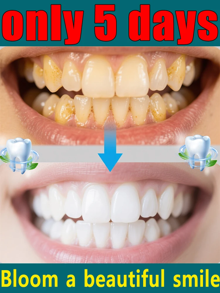 

Teeth shine like bricks, smiles shine like stars