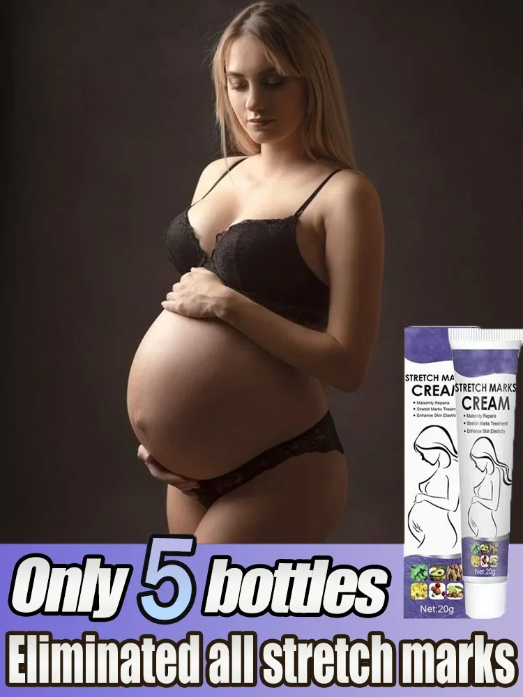

Stretch Marks Permanent Removal Cream Eliminate Body Belly Stretch Marks Swelling Marks Remove Skin Cracks Repair Firming Care