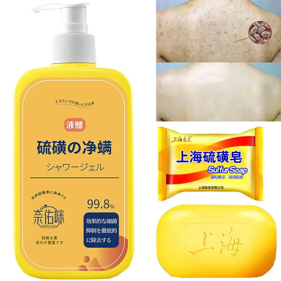

400ml Shower Gel Sulfur Liquid Mite Removal Soap Cleaner Bar Soap Acne Treatment Reduce Oil Keeps Pores Cleaner Hand Sulfur Soap