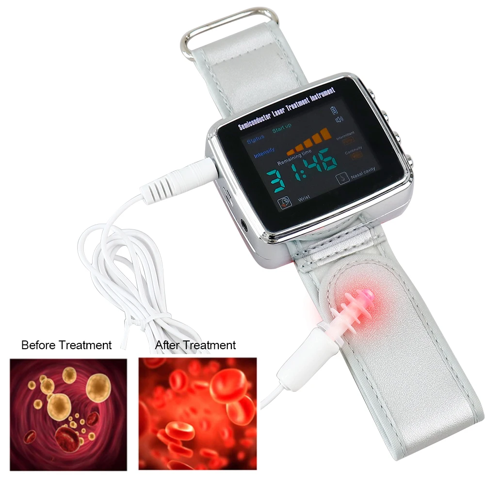 650nm Laser Physiotherapy LLLT Wrist Watch 15 Hole Light Semiconductor Nano Laser Therapy Diabetes Hypertension Sinusitis Device