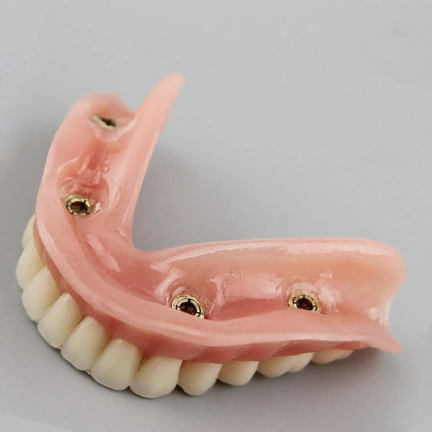 Bild 5: AG Dental-Zahnmodell für den Unterricht, Bildung, Studium, Zahnmedizin, Oberkiefer/Mandibular, Overdenture, Unterkiefer-Zahnmodell
