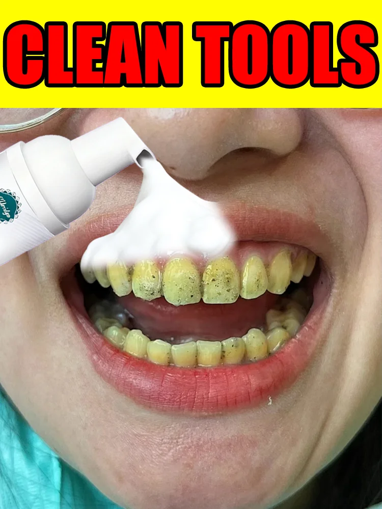 

2025 New upgrade 3.0 Teeth cleaning care tools,unisex,oral foam,Free shipping