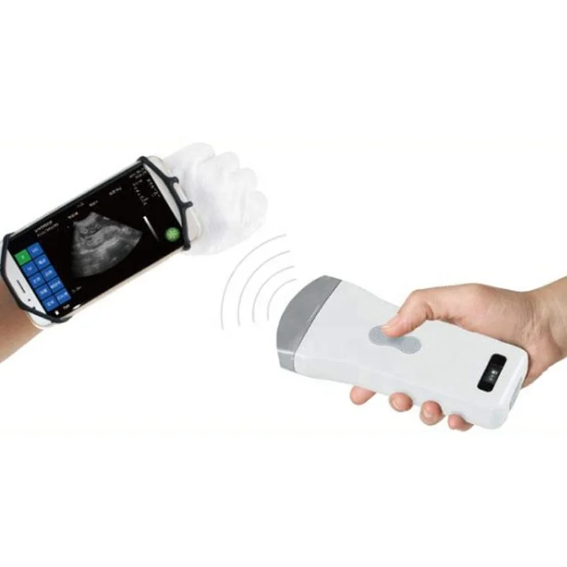 

Wireless Probe Ultrasound Veterinary Portable Wifi Wireless Pocket Ultrasound Scanner