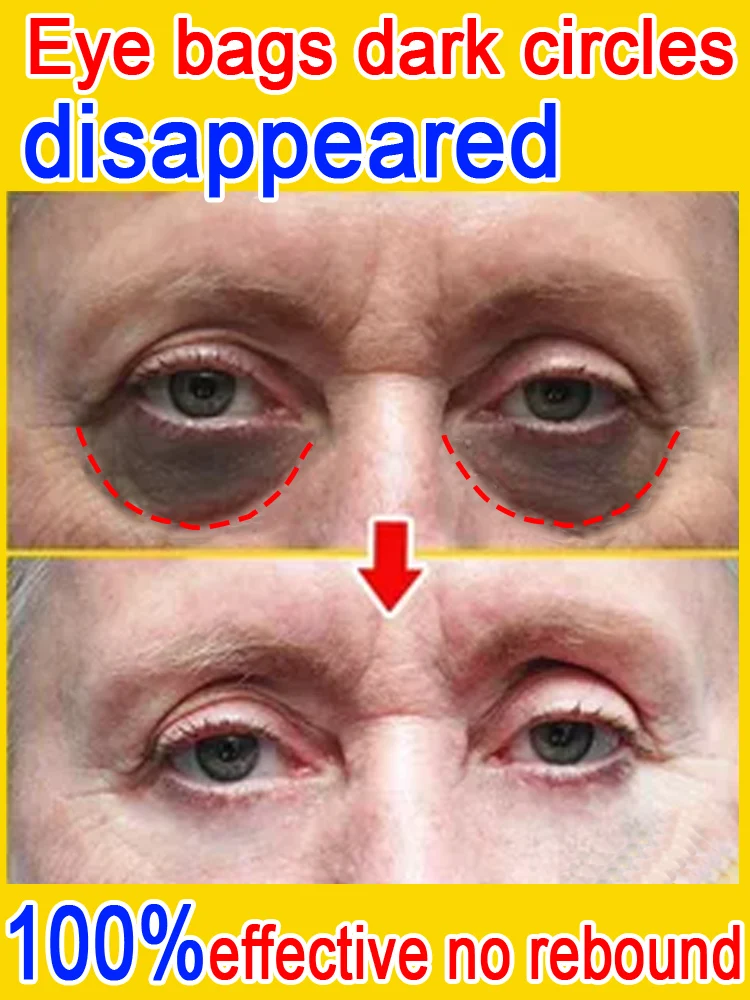 

Dark circles around eyes and sagging eyelids can be easily removed once a day