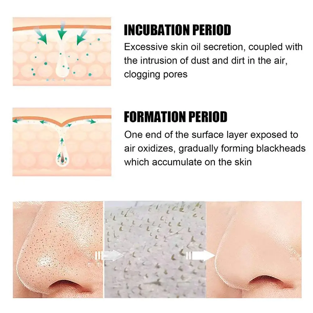 30g +40pcs nasal mask paper Blackhead Remover Cream Cleansing Black Mud Strips Care Mask Nose Peel Dots Acne Skin Off