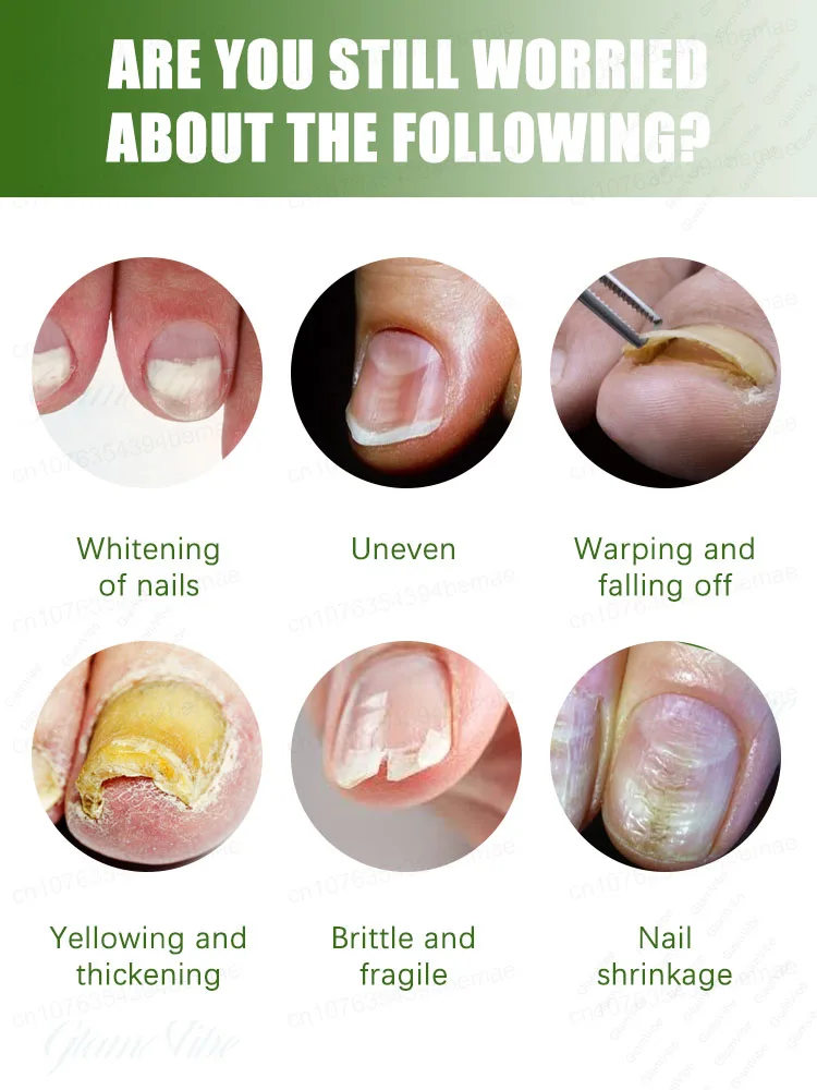 Dᴇᴇᴘ ɪɴᴛᴏ ᴛʜᴇ ɴᴀɪʟ ʙᴇᴅ, ʀᴇᴍᴏᴠᴇ ʙᴀᴄᴛᴇʀɪᴀ ᴀɴᴅ ᴍᴀᴋᴇ ɴᴀɪʟs ʜᴇᴀʟᴛʜʏ