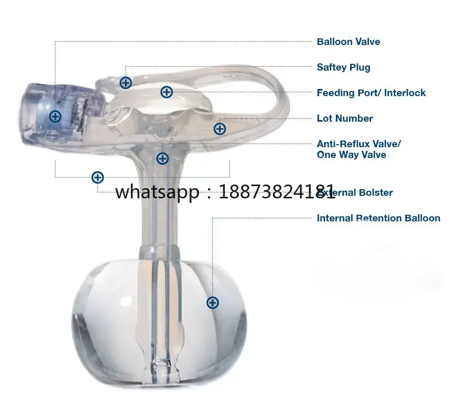 20Fr Silicone Mini G‑Button Tube, Hospital Use Disinfection and Sterilization  Available fast shipping