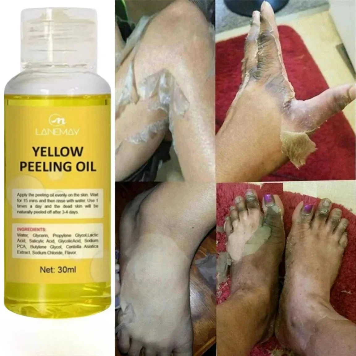 Body Care Exfoliating Yellow Peeling Oil 100% Organic Bleaching Dark Skin Serum Dark Knuckles Fast Whitening Cosmetics