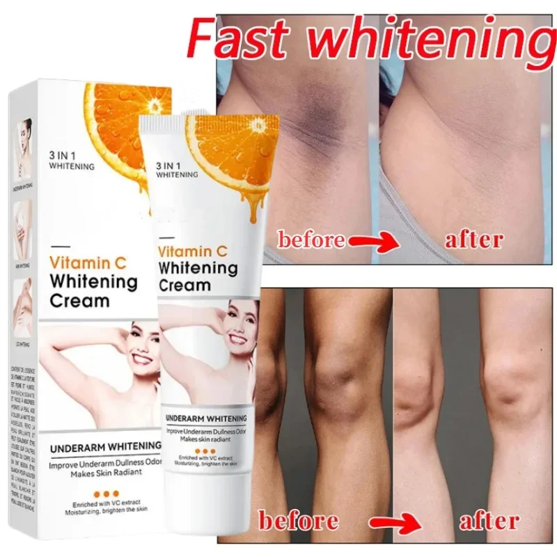 

Nicotinamide Brightening Cream For Dark Skin Effective Lighten Underarm Bleach Remove Melanin Private Parts Brighten Care Cream