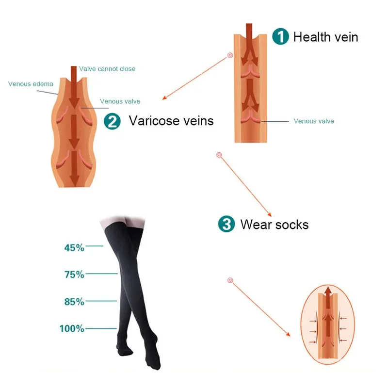 Compression Stockings Men Women,Open Toe,30-40 MmHg Graduated Support Socks DVT,Maternity,Pregnancy,Varicose Veins,Shin Splints