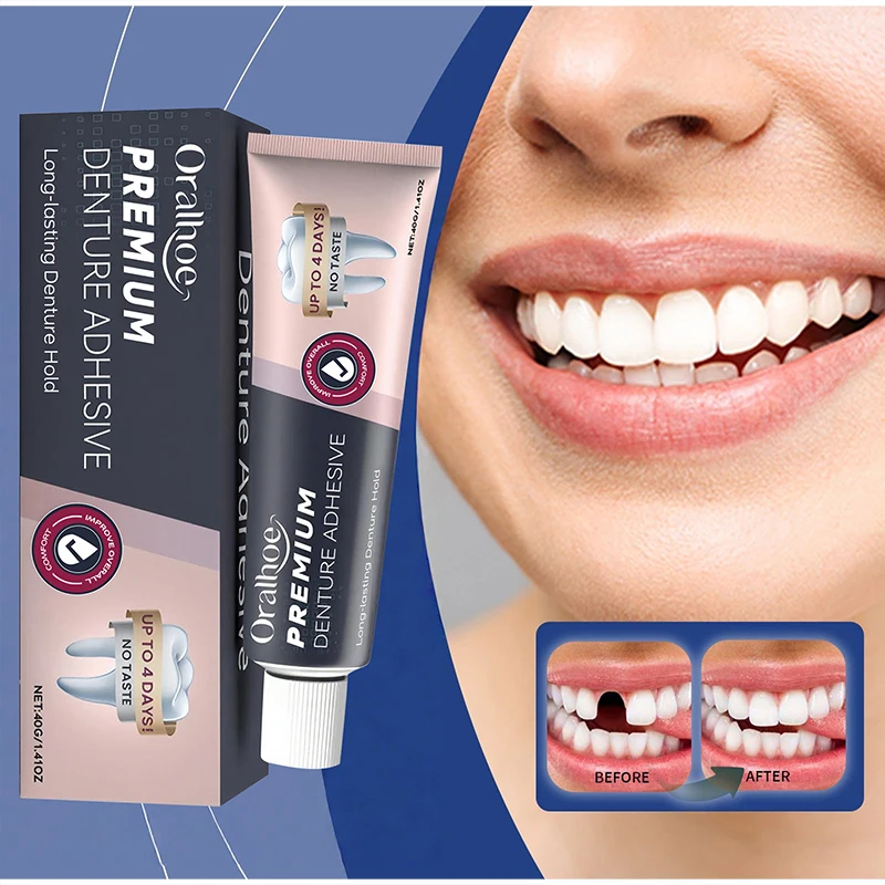 Dental Fixation Adhesive Strong Adhesive Durable Comfortable Denture Glue Fit Daily Oral Aesthetic For Gaps Between Teeth