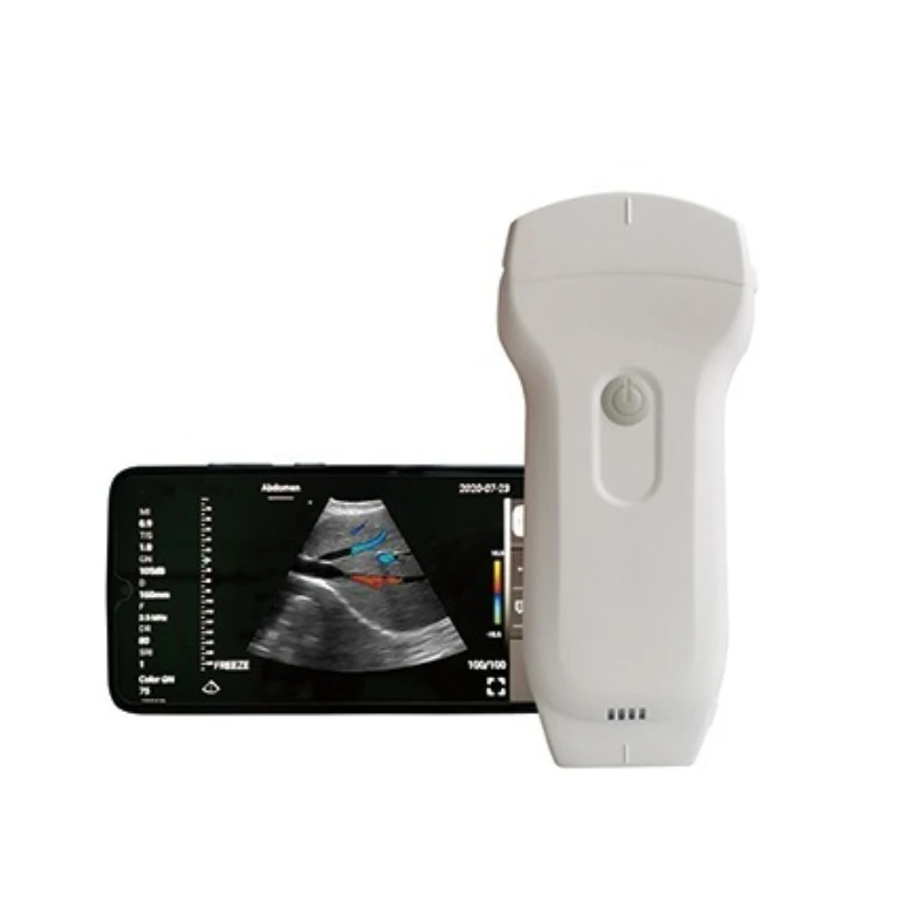 

Yuvnice 3 in 1 Smart Phone Wifi color doppler wireless ultrasound probe wireless Pocket ultrasound Machine for Android, IOS