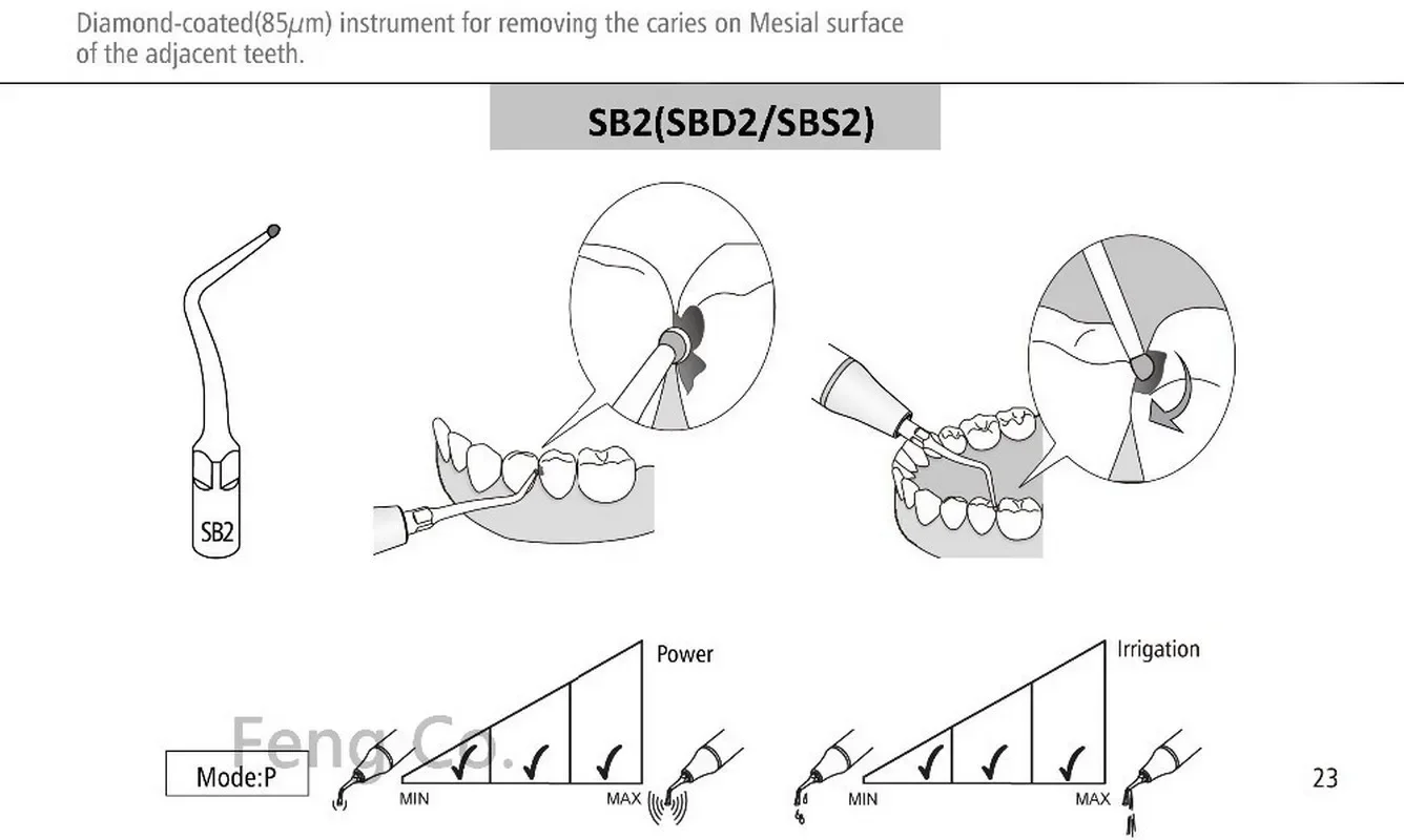 SB2 Ultrasonic Scaler Tips Endo Perio Dental Scaling Fit EMS Woodpecker Handpiece Dentistry Instrument