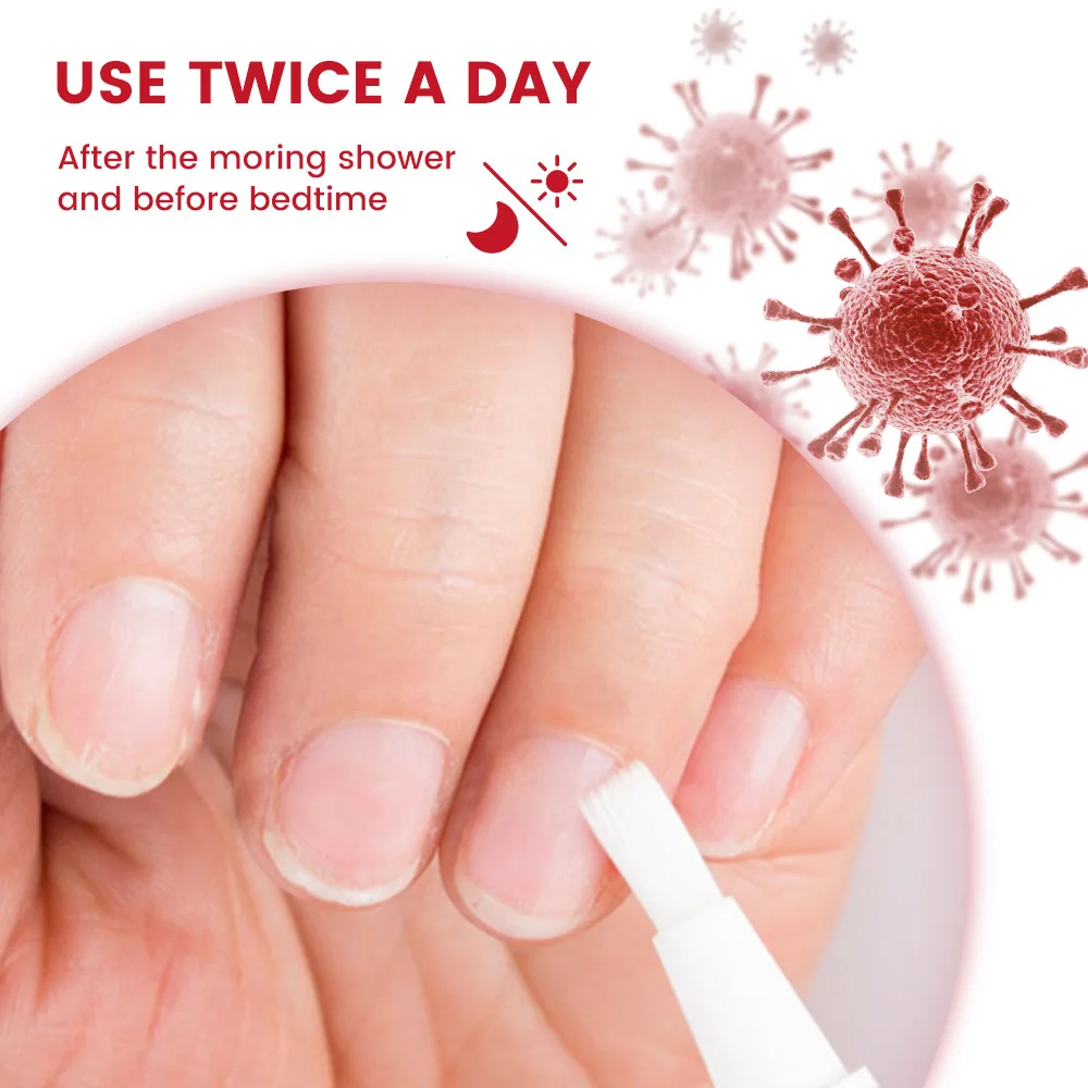 真菌性爪治療血清爪真菌除去治療爪周囲炎液体抗灰色爪足指感染症足修復ケアツール