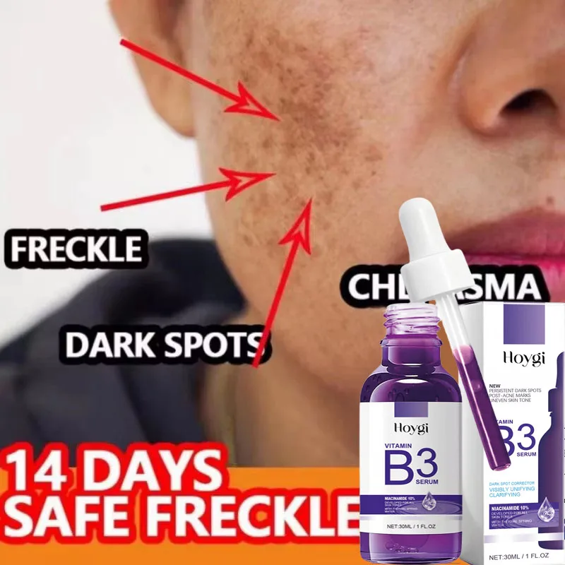 

Vitamin B3 Serum Fade Dark Spot Chloasma Lighten Melanin Pigmentation Smooth Pores Rejuvenation Brightening Moisturizing Essence