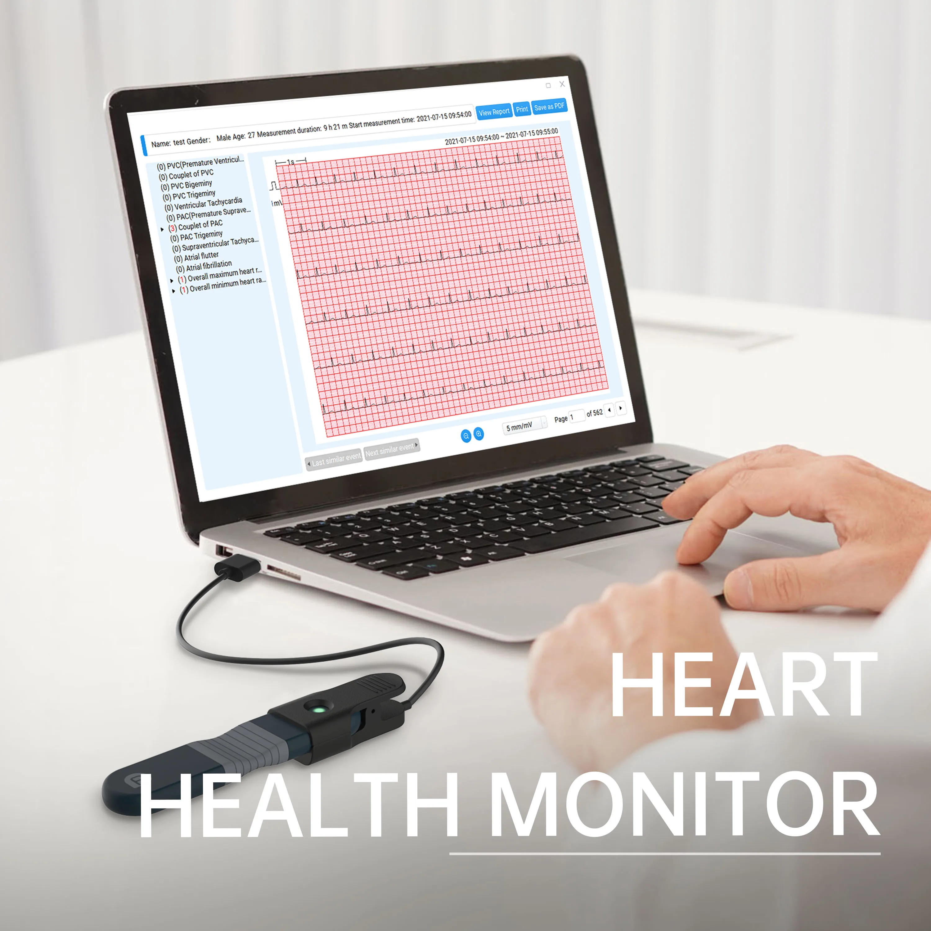 Wellue ER1 24-hour Wearable EKG/ECG Monitor With AI Analysis Real-time Ecg Tracking Portable Ecg Heart Monitor For Home Use