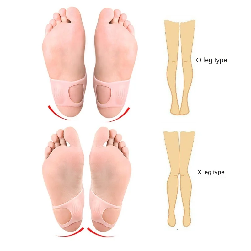 2pcs Silicone Corrector Insoles For Men Women O Type Leg Arch Support Anti Slip Shoes Orthopedic Insole Foot Care Tool Feet Pads