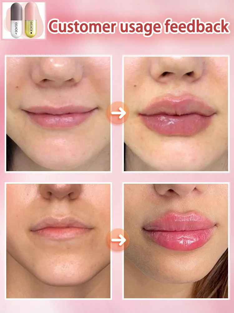 Minyak serum mempertebal bibir, minyak serum penuh bibir