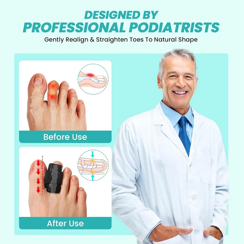 A66Z 망치발가락 교정기 여성 및 남성용-4단계 조절 가능한 발가락 스플린트 랩 알루미늄 플레이트 지지 포함