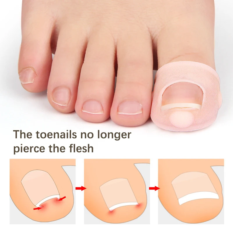 Corretor de polegar em gel de silicone, 2 peças, joanete, pé, hálux valgus, protetor, separador, alisador de dedo, ajustador