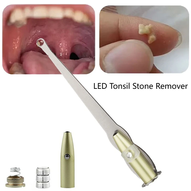 Herramienta profesional para eliminar piedra de amígdal con luz LED, limpiador de acero inoxidable para cuidado bucal y eliminación de cera de los oídos, 1 ud.