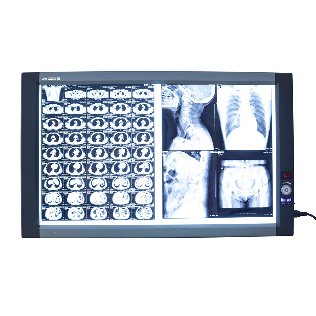 

FY ZG-2C LED Medical X-ray Film Viewer industrial x-ray film viewer X Ray Film Viewer