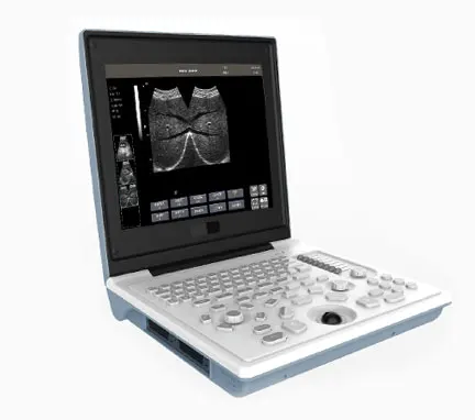 Cheap Price High-definition 12inch Screen Laptop Black And White Medical Ultrasound Instruments Diagnostic System