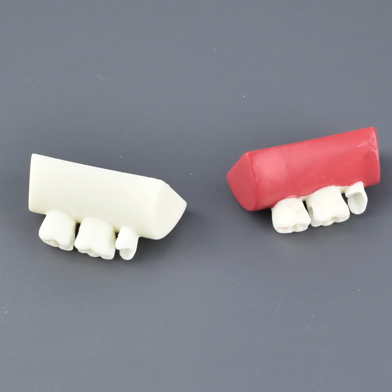 

Inlay Exercise Model Block Filling Exercise Typodont Resin Materials for Dentistry Teaching Study