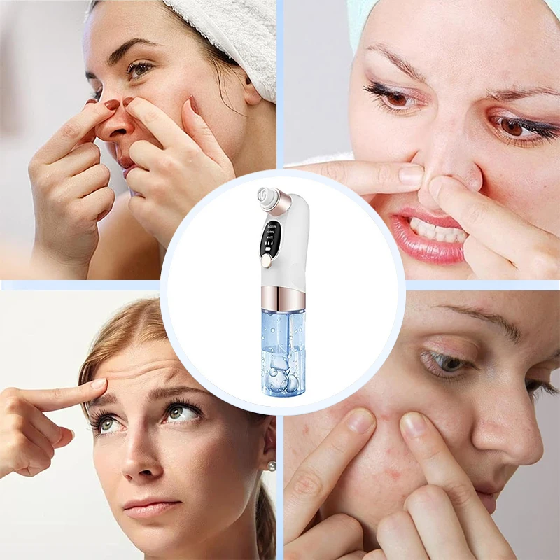 Rosto beleza poros aspirador facial, removedor de cravo, carregamento usb mais novo circulação de água ferramentas de limpeza facial