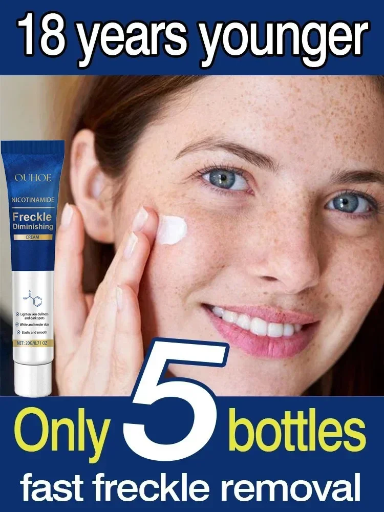 Nicotinamide Brightening Chloasma Cream Effective Lightening Dull Brighten Cream Face Fade Melasma Korean Moisturizing Skin Care